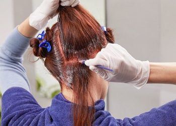 bị dị ứng thuốc nhuộm tóc sưng mặt