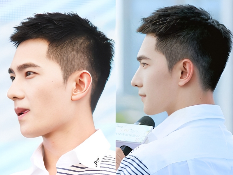 Đầu đinh undercut